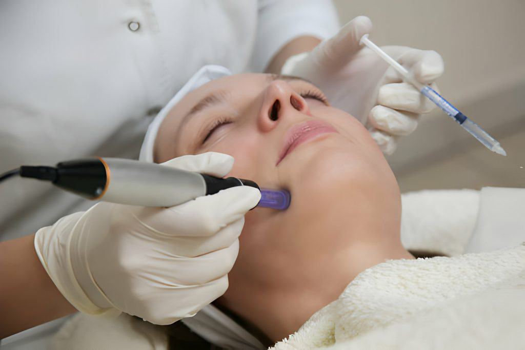 Microneedling treatment